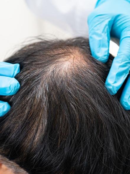 hair-examination-with-gloved-hands-2026-03-26-10-38-07-utc